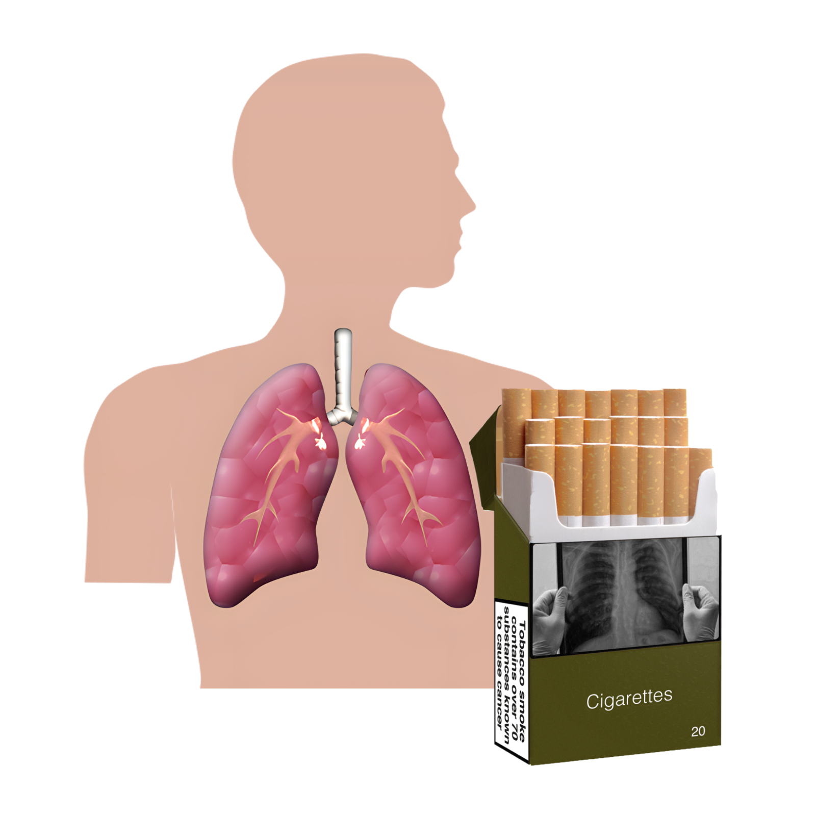 An anatomical illustration showing a human silhouette with lungs highlighted. Next to it is a packet of cigarettes.