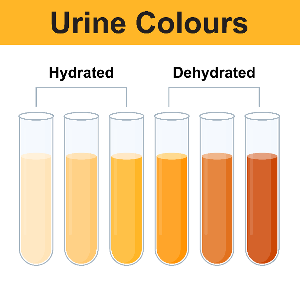 Chart showing urine colours ranging from pale yellow to dark orange. Lighter colours indicate good hydration, while darker colours may be a sign of dehydration.